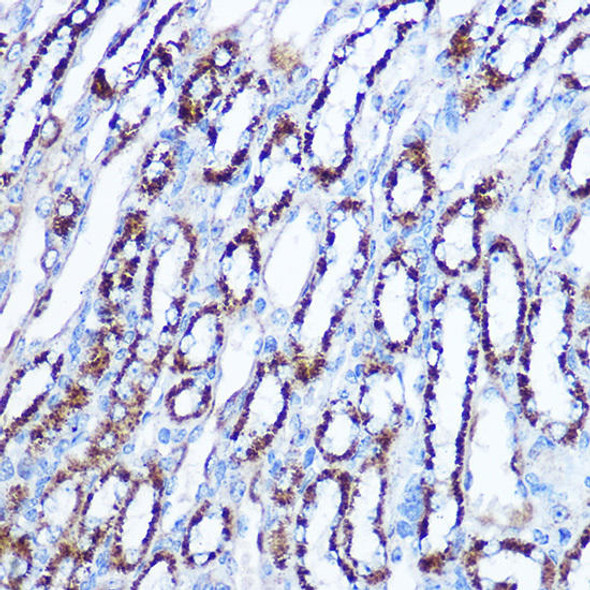 Immunohistochemistry of paraffin-embedded mouse spleen using PLK1 Rabbit mAb at dilution of 1:100 (40x lens). Perform high pressure antigen retrieval with 10 mM citrate buffer pH 6. 0 before commencing with IHC staining protocol.