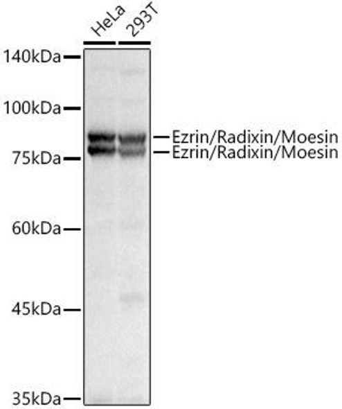 Western blot analysis of extracts of various cell lines, using Ezrin/Radixin/Moesin antibody at 1:1000 dilution. Secondary antibody: HRP Goat Anti-Rabbit IgG (H+L) at 1:10000 dilution. Lysates/proteins: 25ug per lane. Blocking buffer: 3% nonfat dry milk in TBST. Detection: ECL Basic Kit. Exposure time: 0. 8s.