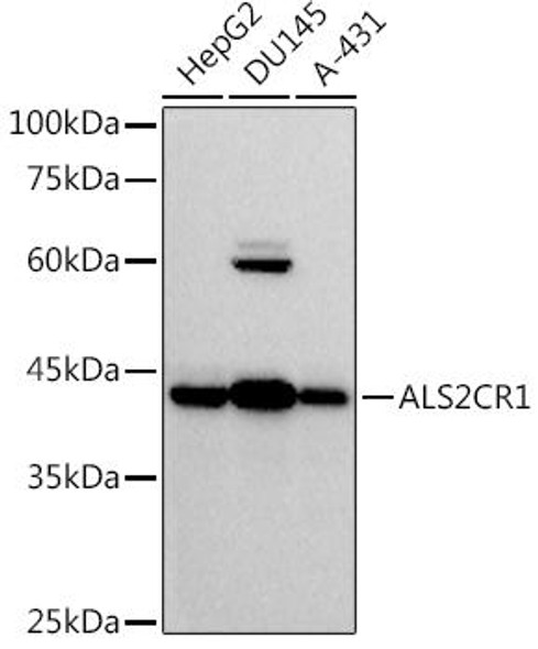 Western blot analysis of extracts of various cell lines, using at 1:500 dilution. Secondary antibody: HRP Goat Anti-Rabbit IgG (H+L) at 1:10000 dilution. Lysates/proteins: 25ug per lane. Blocking buffer: 3% nonfat dry milk in TBST. Detection: ECL Basic Kit. Exposure time: 10s.