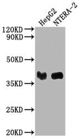 Western Blot<br />
Positive WB detected in: HepG2 whole cell lysate, NTERA-2 whole cell lysate<br />
All lanes: LCMT1 antibody at 1:2000<br />
Secondary<br />
Goat polyclonal to rabbit IgG at 1/50000 dilution<br />
Predicted band size: 39, 42, 33 kDa<br />
Observed band size: 39 kDa<br />