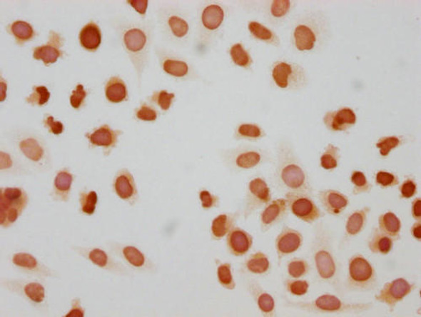 Immunocytochemistry analysis of PACO65025 diluted at 1:10 and staining in Hela cells(treated with 50nM Calyculin A for 30min) performed on a Leica BondTM system. The cells were fixed in 4% formaldehyde, permeabilized using 0.2% Triton X-100 and blocked with 10% normal goat serum 30min at RT. Then primary antibody (1% BSA) was incubated at 4&deg;C overnight. The primary is detected by a biotinylated secondary antibody and visualized using an HRP conjugated SP system.