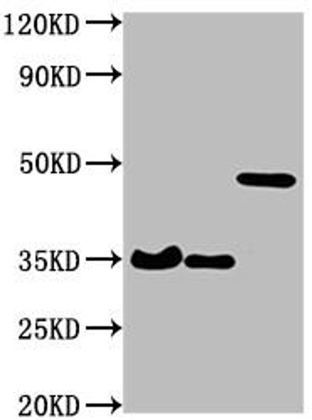 Western Blot<br />
Positive WB detected in: 3 different overexpression lysates with HA tagged<br />
All lanes: HA-Tag antibody at 1:1000<br />
Secondary<br />
Goat polyclonal to Mouse IgG at 1/10000 dilution<br />
Predicted band size: 35, 35, 48 kDa<br />
Observed band size: 35, 35, 48 kDa</p>