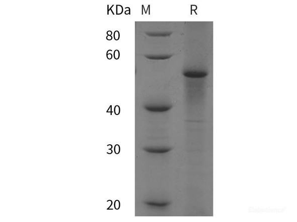 Bovine P53/TP53 Recombinant Protein (His tag)