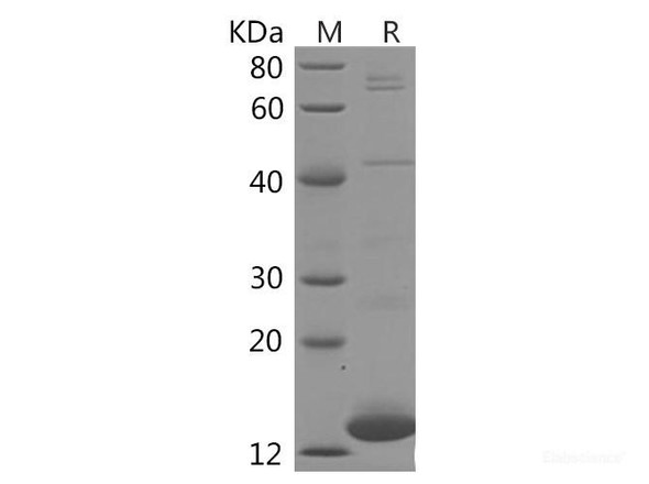 Human FABP3 Recombinant Protein (His Tag)