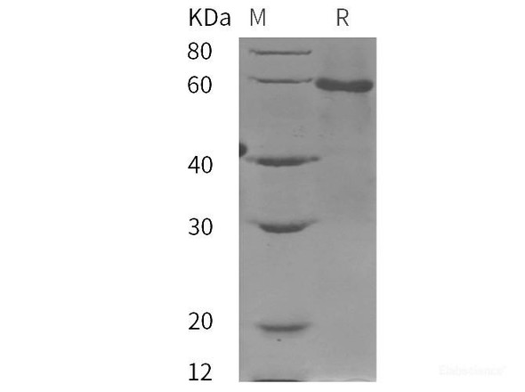 Human AMH Recombinant Protein (His tag)