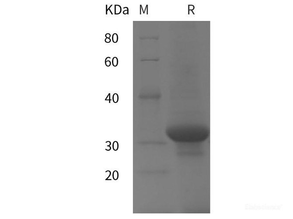 Human UCP1 Recombinant Protein (His tag)