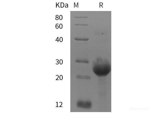Human ABL1/c-Abl  Recombinant Protein (His tag)