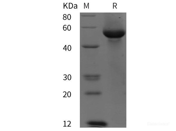 Human G6PD Recombinant Protein (His tag)