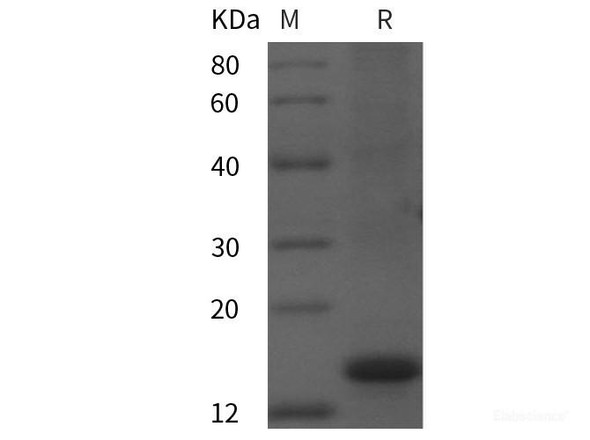 Human CFHR1 Recombinant Protein (His tag)