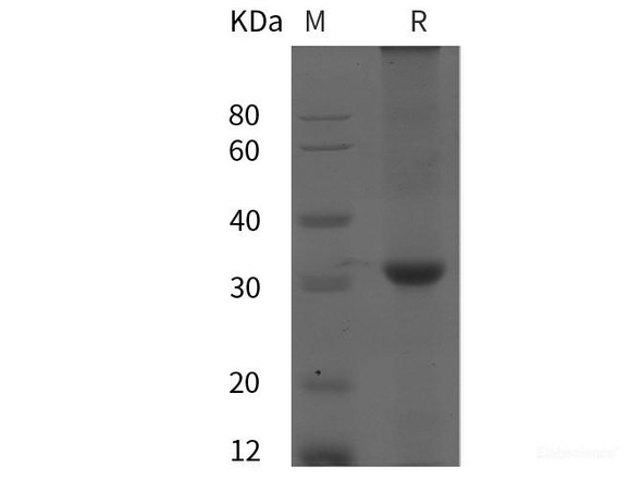 Human BACE1 Recombinant Protein (His tag)
