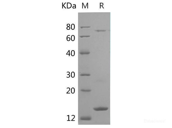 Human Ub Recombinant Protein (His tag)