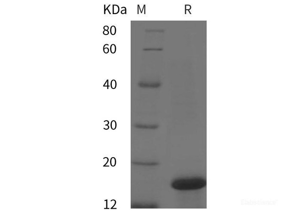 Human IL2/IL-2/Interleukin-2 Recombinant Protein (His tag)
