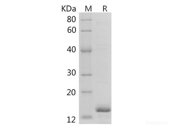 Human Galectin-1/LGALS1 Recombinant Protein (His tag)