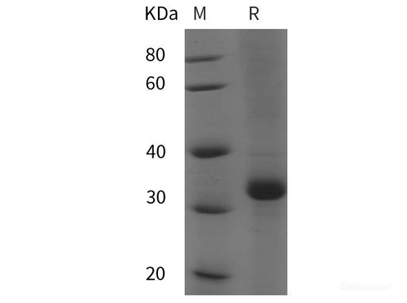 Human  LEPR/CD295 Recombinant Protein (His tag)