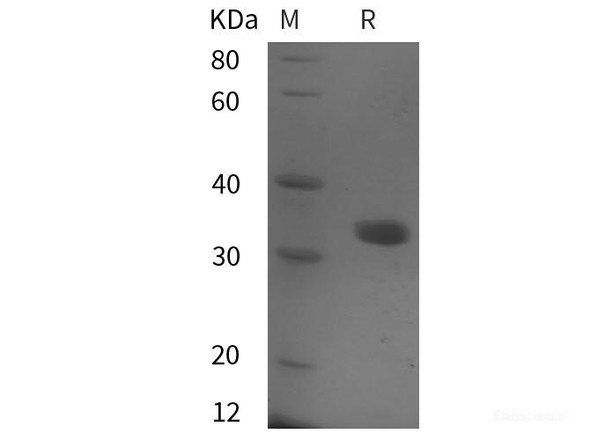 Human MCM5 Recombinant Protein (His tag)