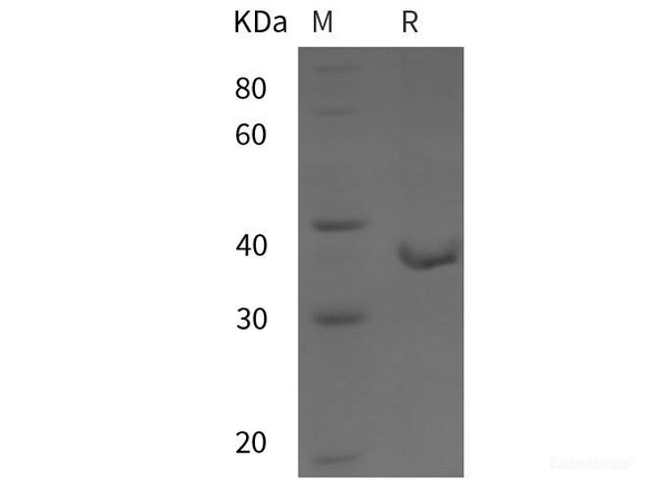 Human MAP4K2 Recombinant Protein (His tag)