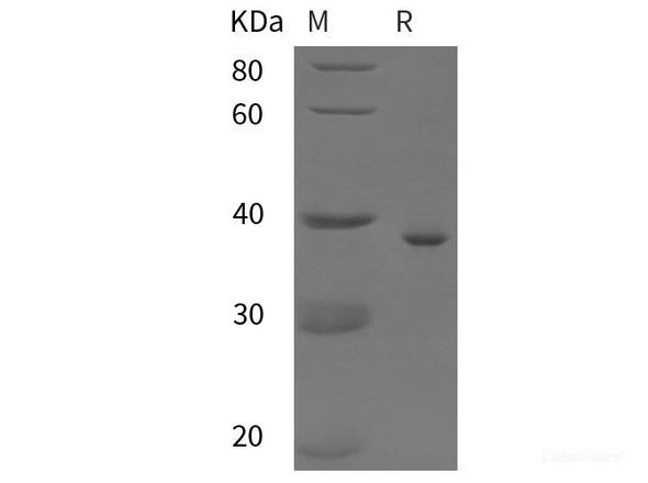 Human Cytokein19 Recombinant Protein (His tag)