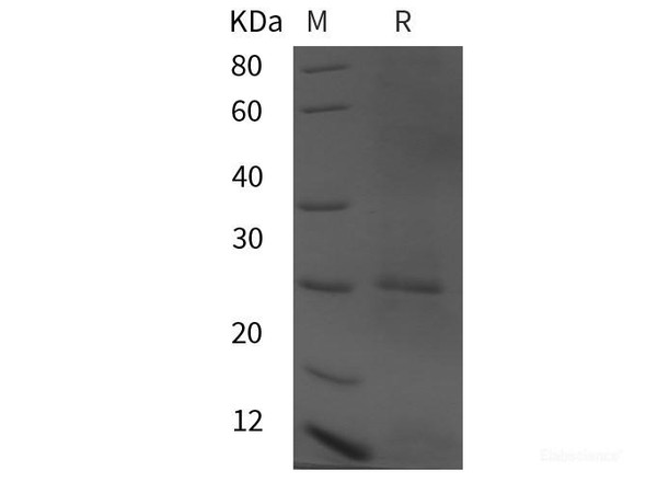 Human AIMP2 Recombinant Protein (his tag)