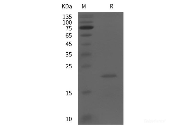 Human ARF6 Recombinant Protein (His tag)