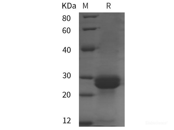 Mouse IL-33 Recombinant Protein (His tag)