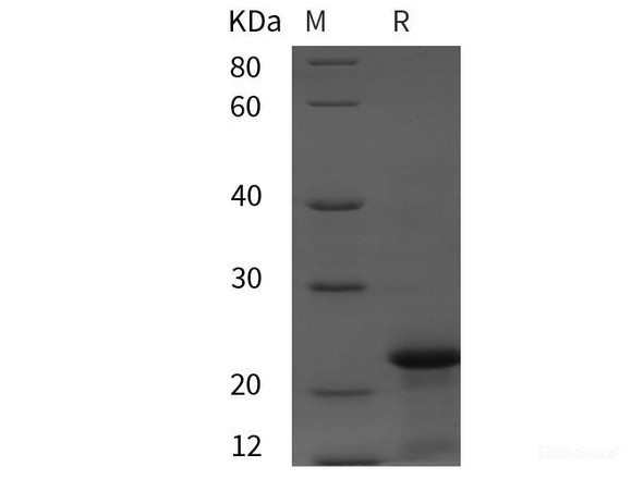 Rat Calcitonin/CT Recombinant Protein (TRX,His tag)