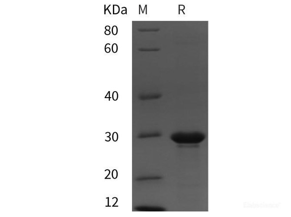 Rat NT-proBNP Recombinant Protein (GST tag)