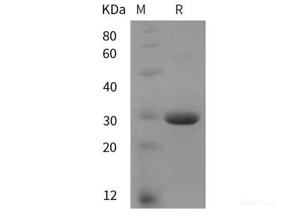 Rat ANG2 Recombinant Protein (His tag)