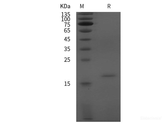 Rat AAT Recombinant Protein (His tag)