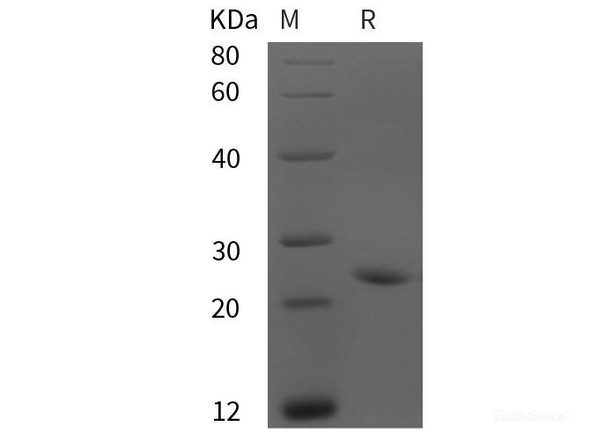 Rat Adrenomedullin/ADM Recombinant Protein (His tag)