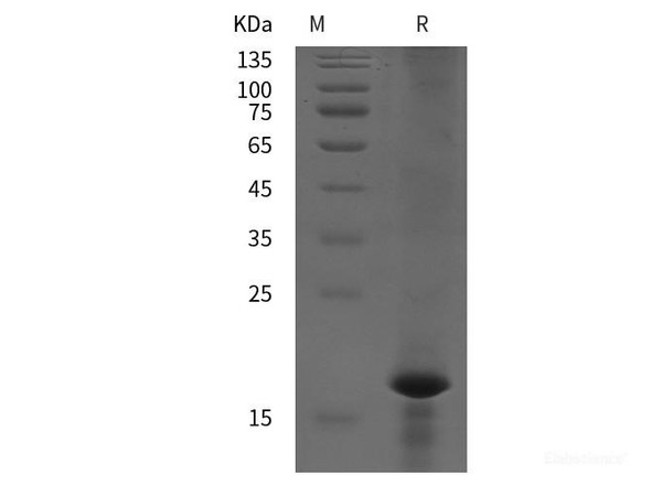 Rat AIF-M1 Recombinant Protein (His tag)