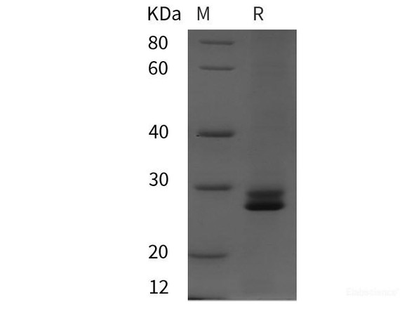 Rat ACE Recombinant Protein (His tag)