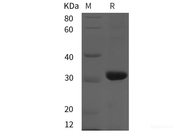 Rat CD38/ADPRC1 Recombinant Protein (His tag)