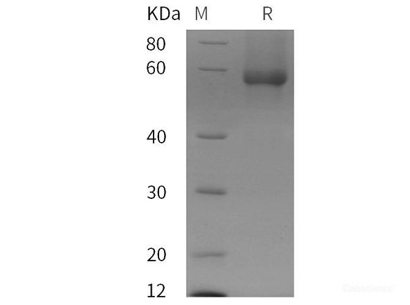 Human Glypican-1/GPC1 Recombinant Protein (His tag)
