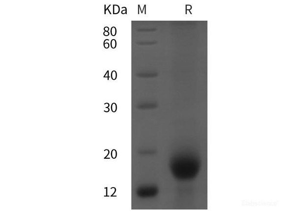 Human CD59 Recombinant Protein (His tag)