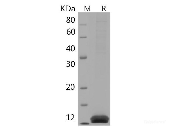 Human IL-2 Recombinant Protein (His tag)
