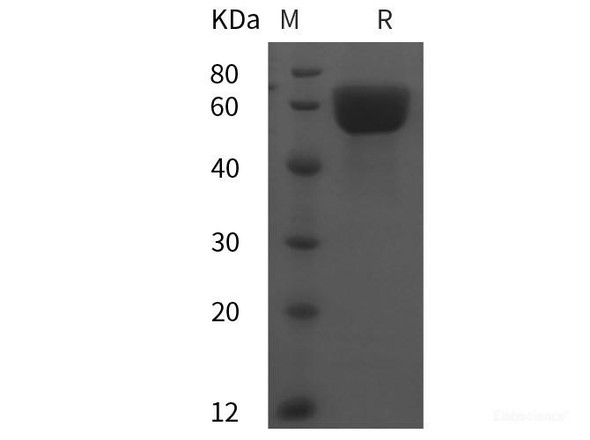 Rat Angiotensinogen/AGT Recombinant Protein (His tag)