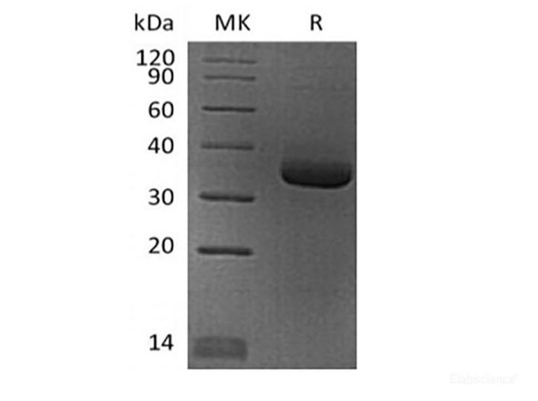 Human Angiopoietin-Related Recombinant Protein 4/ANGPTL4 (N-6His)