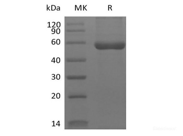 Human HLA-A*0201 WT-1 complex Recombinant Protein (C-10His)
