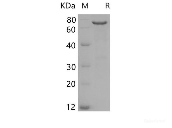 Human  Merlin/NF2 Recombinant Protein (His Tag)