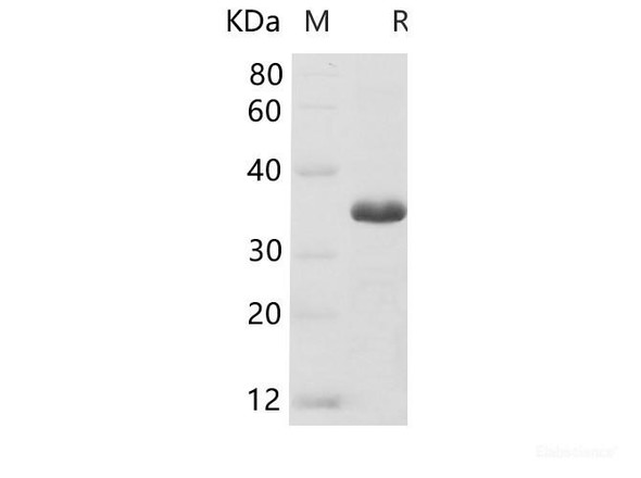 Human  GAPDH Recombinant Protein (His Tag)