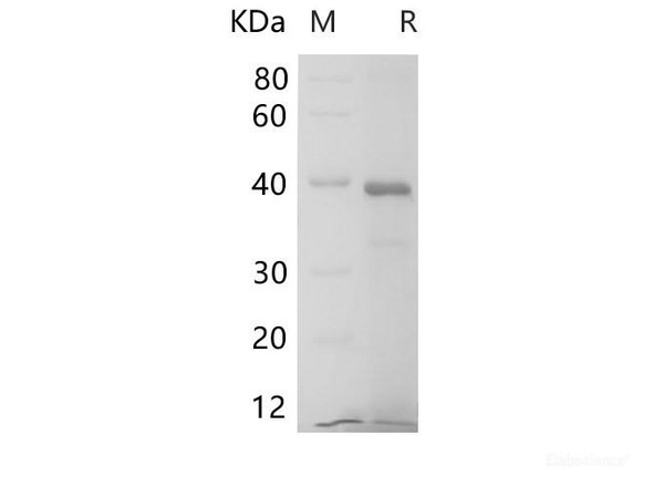 Human IL6R Recombinant Protein (His Tag)