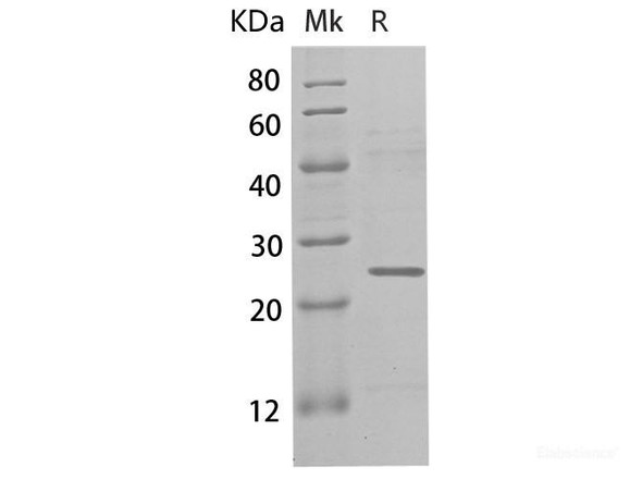 Human β-Casein/CSN2 Recombinant Protein (His Tag)