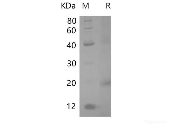 Rat Alpha-fetoRecombinant Protein Recombinant Protein (His Tag)