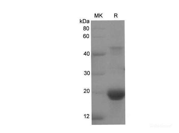 Rat AMPK alpha2 Recombinant Protein (His Tag)
