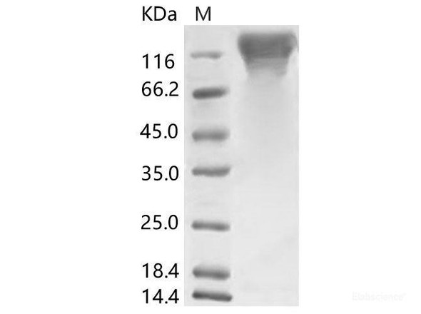 HCoV-HKU1 (Isolate N5) S1 Recombinant Protein (His Tag)
