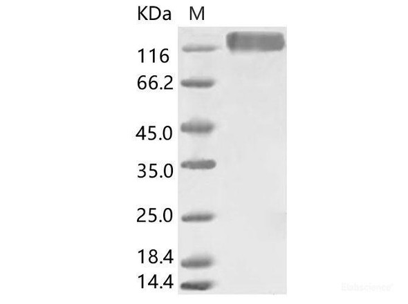 HCoV-229E S1+S2 Recombinant Protein (ECD, His Tag)