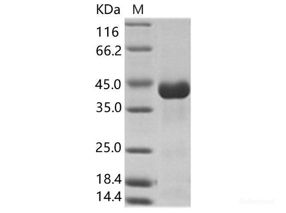 CHIKV (strain SL-CK1) Envelope 2 Recombinant Protein (His Tag)