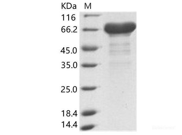 EBOV (subtype Zaire, strain H.sapiens-wt/GIN/2014/Kissidougou-C15) VP40 / Matrix Recombinant Protein VP40 Recombinant Protein (His & MBP Tag)