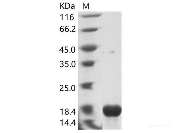 EBOV (Sudan ebolavirus, strain Gulu) NucleoRecombinant Protein / NP Recombinant Protein (His Tag)