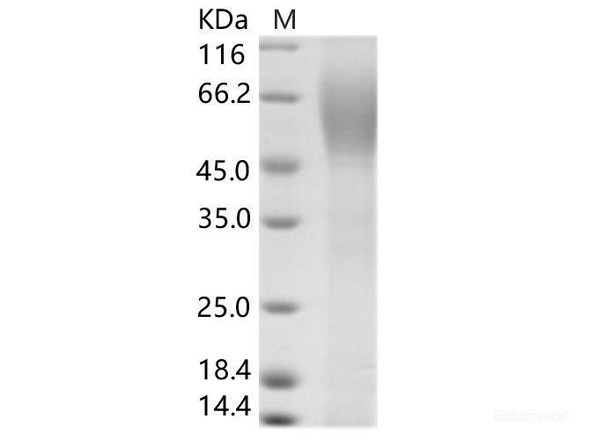 HCV (serotype 1b, isolate HC-J4) Envelope / E2 Recombinant Protein (His Tag)